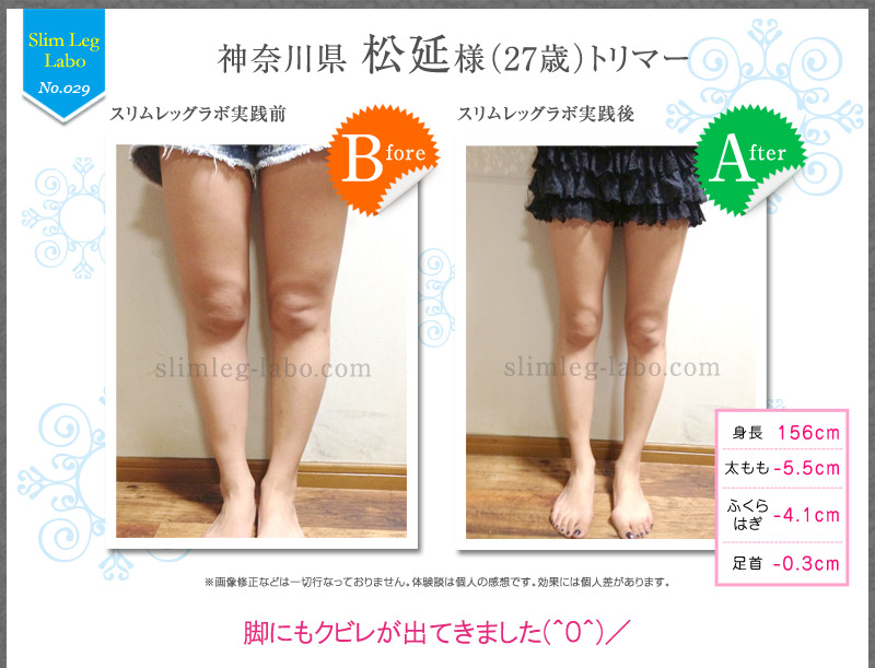 下半身ダイエット成功者 松延さん 27歳 の告白 下半身ダイエット成功者が極秘に脚痩せを教えるブログ